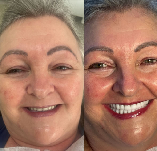 ANTES E DEPOIS.2