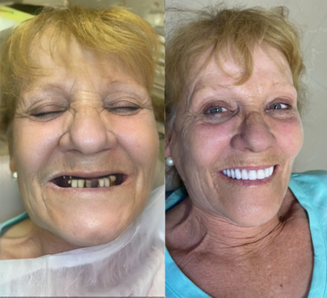 ANTES E DEPOIS.3