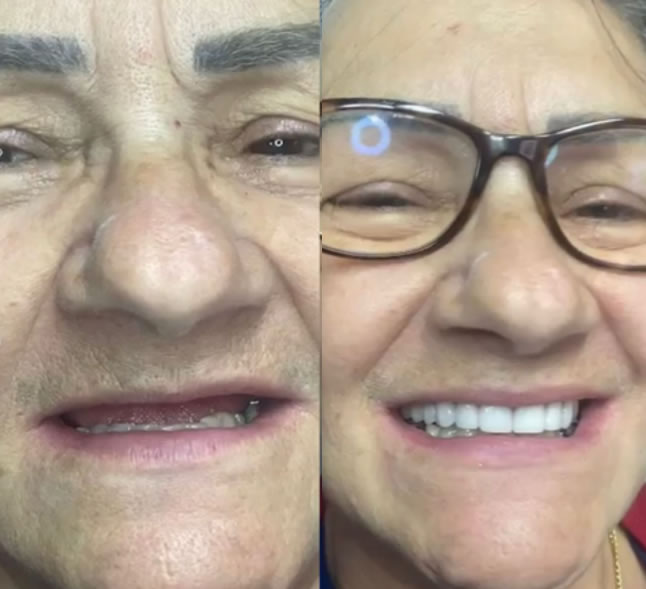 ANTES E DEPOIS.4
